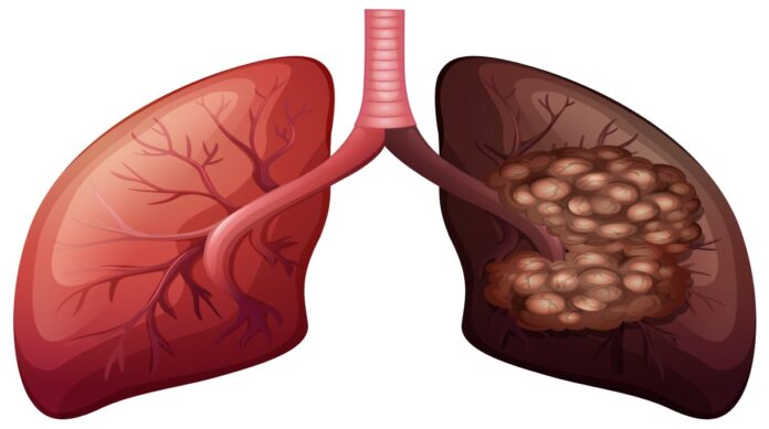 lungs natural cleaning remedy tips