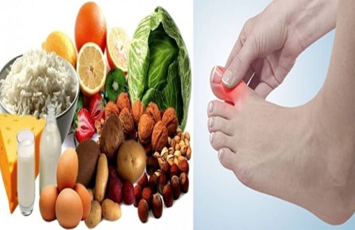 These 5 things extract Uric Acid from body