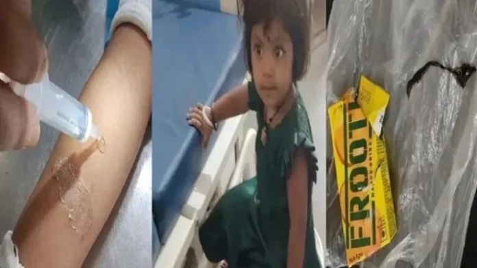 छिपकली