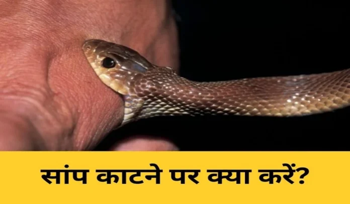 Snake Bite