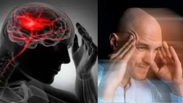 स्ट्रोक